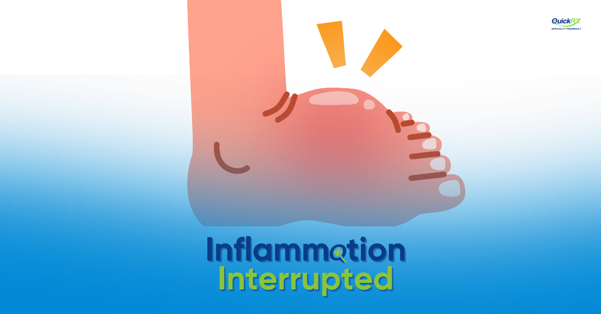 Swollen inflamed foot illustrating joint inflammation in arthritis