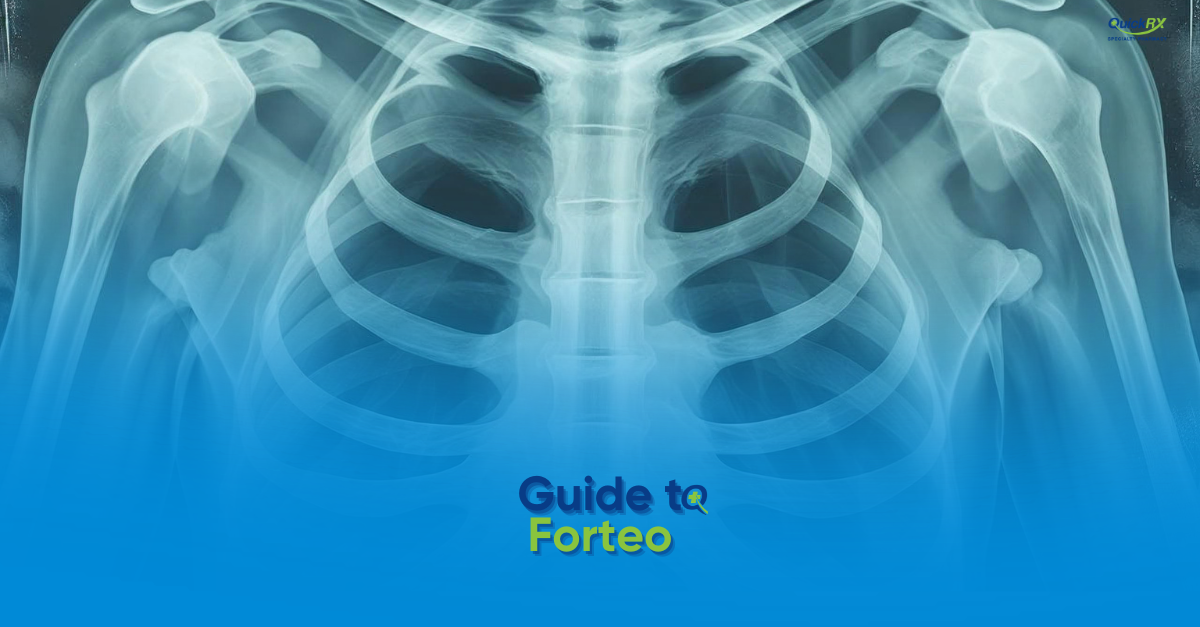 An X-ray showing the rib cage, shoulders, and upper skeleton on a blue background, with the title "Guide to Forteo" and the QuickRx Specialty Pharmacy logo.