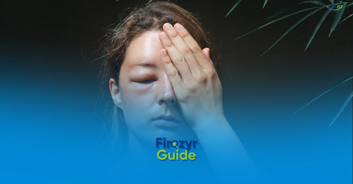 A woman with visible facial swelling around one eye holding her hand to her face, with the title "Firazyr Guide" and the QuickRx Specialty Pharmacy logo.