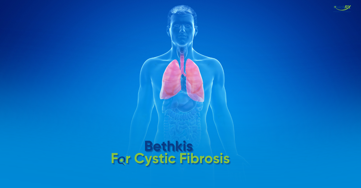 Blue anatomical illustration of a human figure with highlighted lungs, for a QuickRX Specialty Pharmacy guide to Bethkis for cystic fibrosis