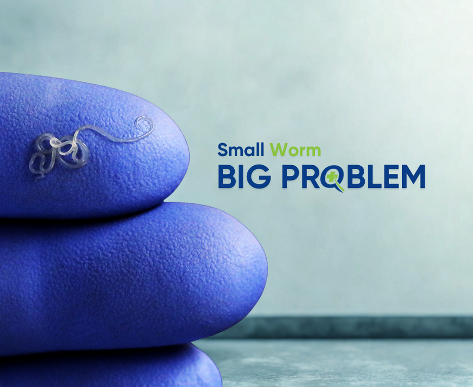 Tiny parasitic worm on gloved fingers, symbolizing infections treated with Biltricide