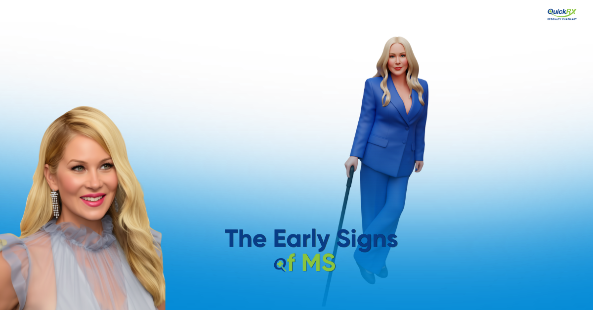 Early Signs Of Ms